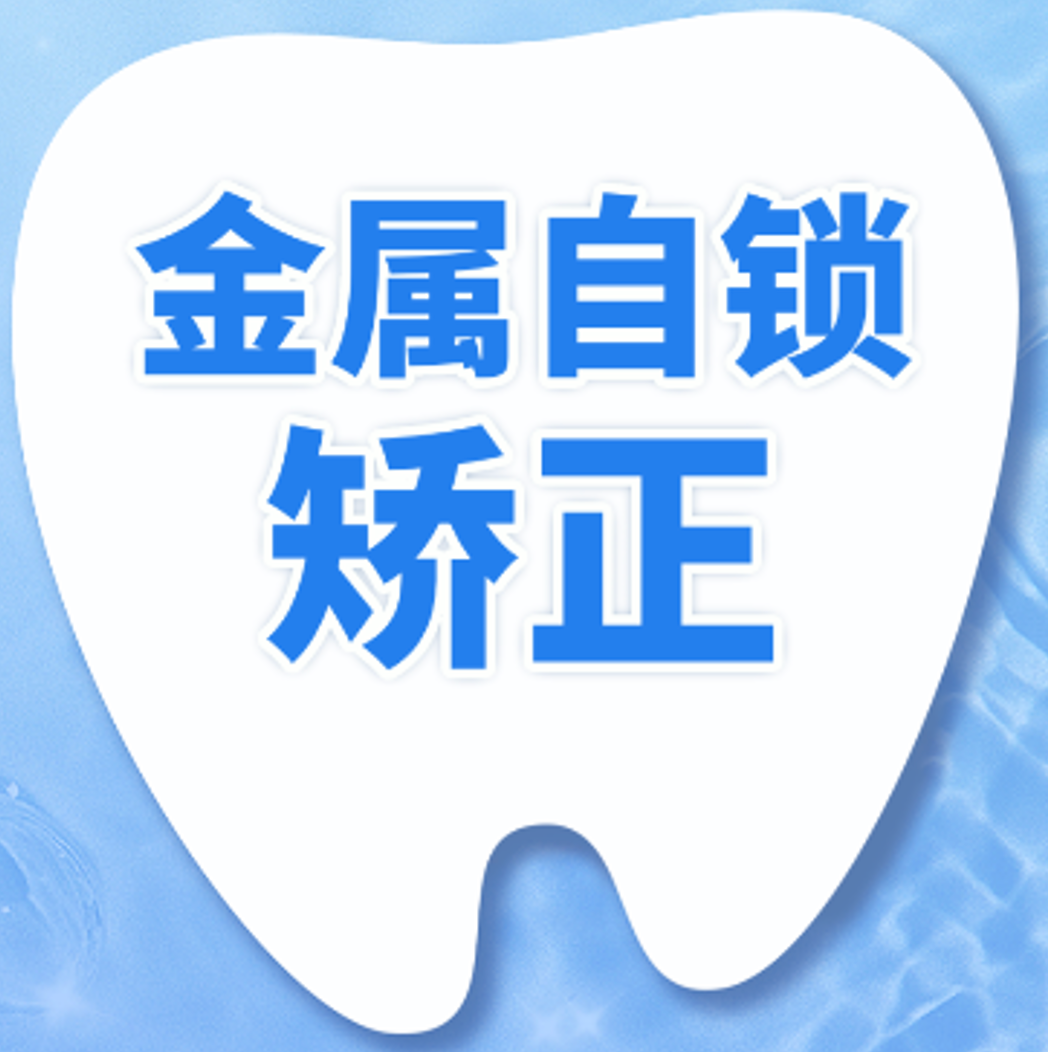 固定矫正|金属自锁托槽矫正（非拔牙）